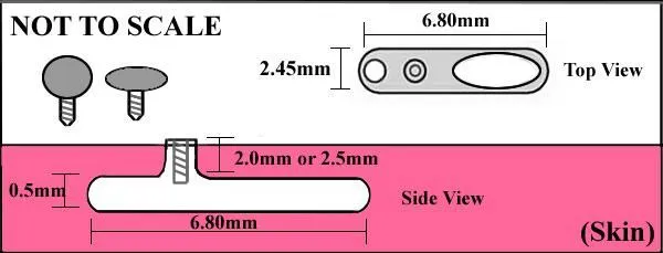 Tilum Male Sex Toys Tilum 14g Titanium Dermal Anchor with 2mm or 25mm Rise DoubleHole Base Price Per 1