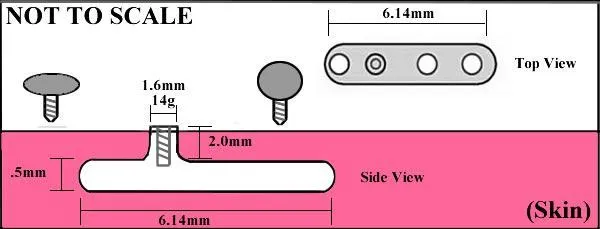 Vibrators Painful Pleasures 14g 12g Internally Threaded Dolphin Top Price Per 1
